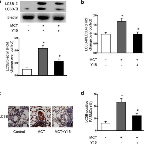 Inhibition Of Fak Prevents The Activation Of Autophagy In Mct Induced