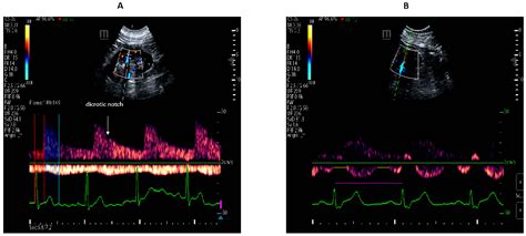 Jcm Free Full Text Electrocardiographic Time Intervals Waveforms As