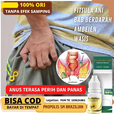 Jual Psm Salep Oles Untuk Anus Terasa Perih Dan Panas Setelah Bab