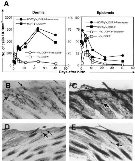 Changes In The Number Of Dopa Positive Cells Melanocytes And