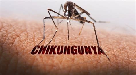 Cara Menyembuhkan Demam Chikungunya Cara Menyembuhkan Penyakit