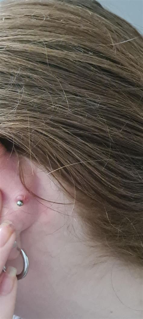 Bump Aorund My Conch Piercing R Piercingadvice