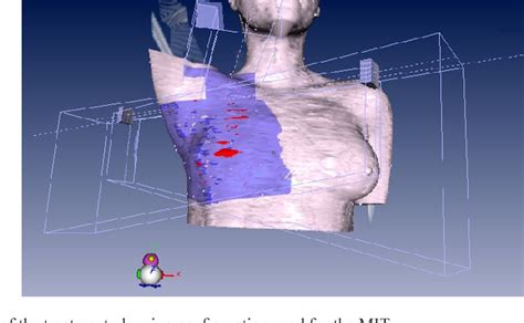 Figure 1 From Comparing The Monoisocentric And Dual Isocentric