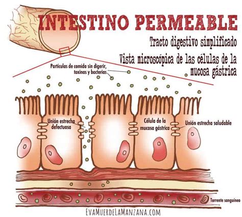 Quieres Saber Si Tienes El S Ndrome Del Intestino Permeable