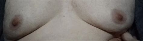 Boy Boobs Sissy Tits Gyno Guy Pics XHamster