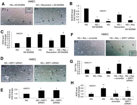 Sirt1 Knockdown Or Foxo1 Inhibition In Ng Induces Signs Of Early Aging