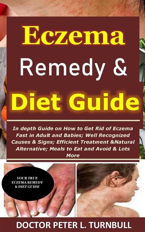 Eczema Remedy And Diet Guide In Depth Guide On How To Get Rid Of Eczema