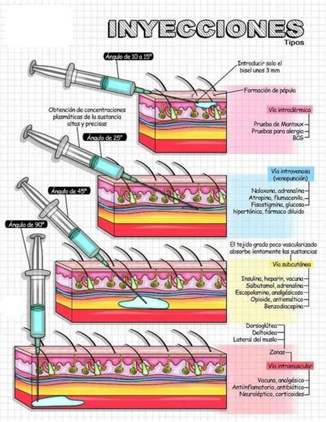 Tipos De Inyecciones Fraii Udocz