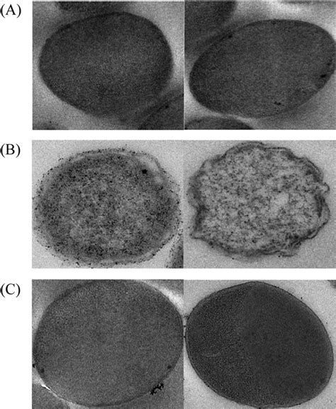 TEM Images Of E Coli BL21 DE3 Cells Containing Target Plasmid A