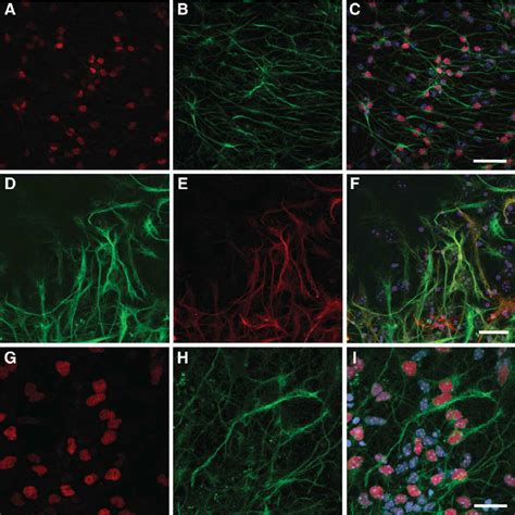 Characterization Of Subventricular Zone Svz Stem Cell Cultures The