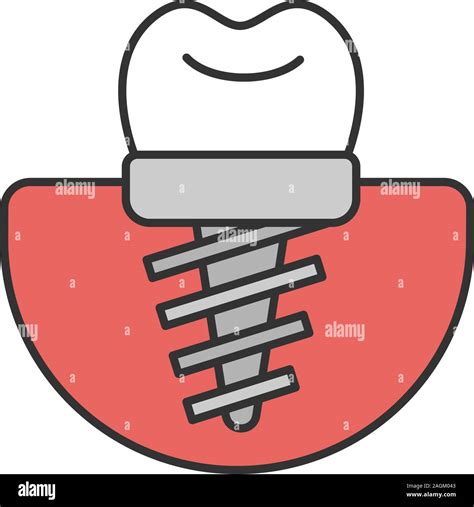 El Icono Color De Implantes Dentales Implante Endo Ilustraci N