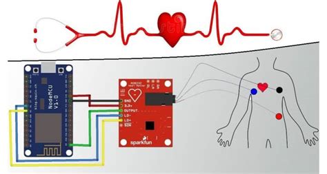 Iot Based Ecg And Heart Rate Monitoring