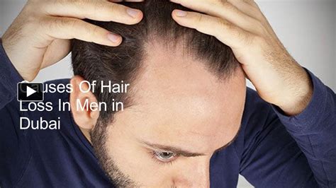 Ppt Causes Of Hair Loss In Men In Dubai Powerpoint Presentation