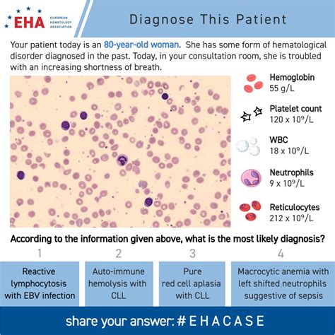 European Hematology Association On Twitter Welcome To Ehacase This