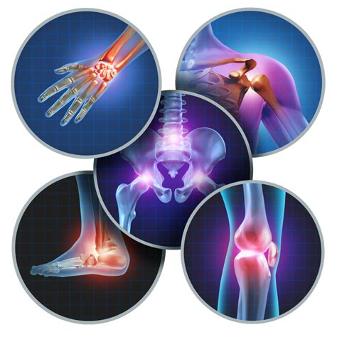 What You Need to Know About Osteoarthritis: Prevention and Treatment