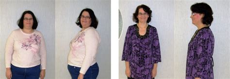 Stacy S Weight Loss Transformation St Louis Bariatrics