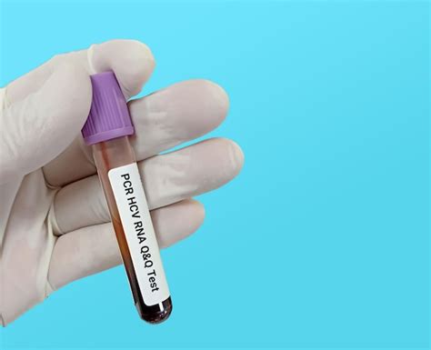 Bioquímico ou tecnólogo de laboratório detém amostras de sangue para