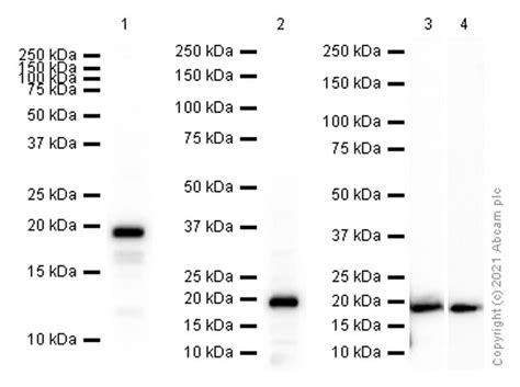 Myosin Light Chain 2 Antibody Sampler Kit | Shelly Lighting