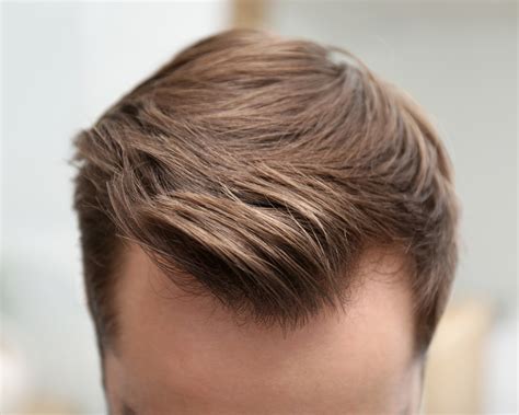 10 Best Mens Hairstyles For Receding Hairline Salt Grooming