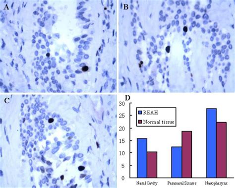 Epstein Barr Virusencoded Rna Eber In Situ Hybridization Ish Of Download Scientific