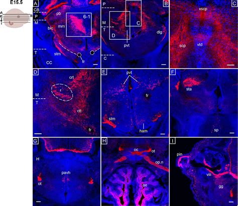 Distinct Opsin 3 Opn3 Expression In The Developing Nervous System