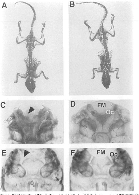 Figure 1 from The thick tail mutation contains anomalies of the axial