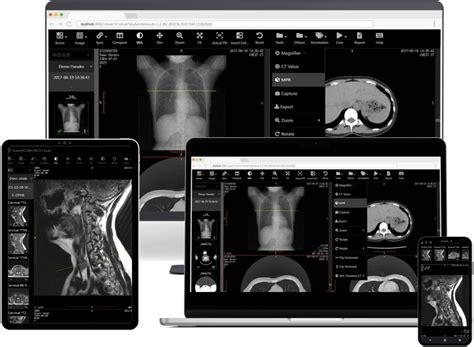 Instantly Access and Analyze Medical Images: Meet the Game-Changing ...
