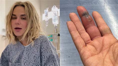 CJ Perry Reveals What Led To Her Finger Infection That Required Surgery