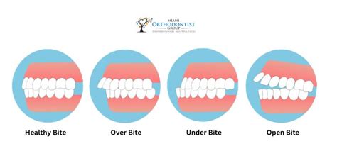 The Importance Of Dental Appliances For Oral Health Maintenance