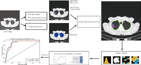 Figure 1 From Comparison Of Diagnostic Performance Of Spread Through Airspaces Of Lung