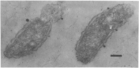 Postembedding Label Of A C Crescentus Cb Mutant K Selected As