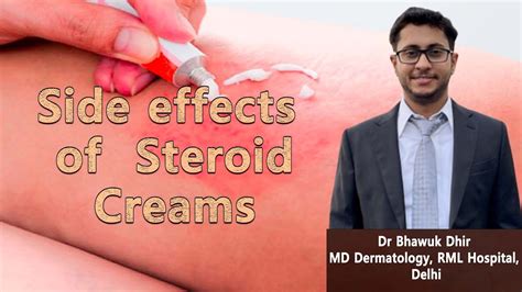 Side Effects Of Steroid Creams Ft Dr Bhawuk Dhir Md Dermatology Rml