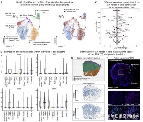 Immunity Tissue Cytometry原位单细胞精准定量技术结合空间转录组揭示肉芽肿和TLS的形成可能具有相同的生物学过程 知乎