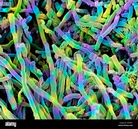 Streptomyces Coelicoflavus Bacterias Color An Lisis Micrograf A De