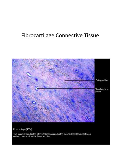 PPT - Loose Fibrous Connective Tissue PowerPoint Presentation, free ...