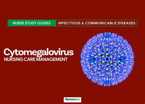 Cytomegalovirus Cmv Nursing Care Management Nurseslabs