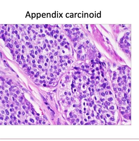 Acquired GI Disorders Flashcards Quizlet