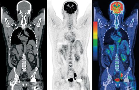 PET CT Sonimagem