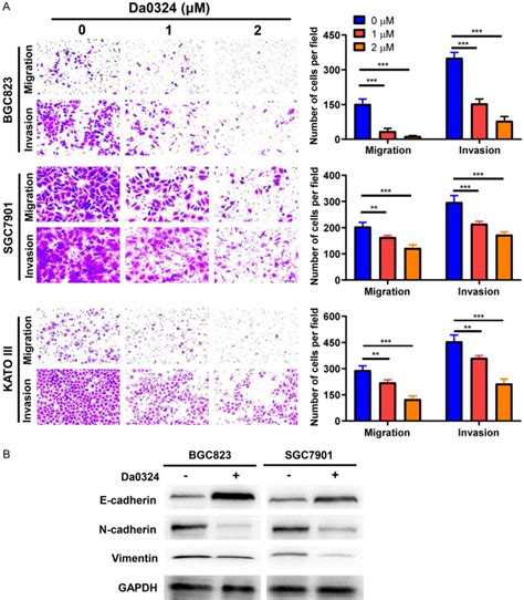 Downregulation Of Linc01021 By Curcumin Analog Da0324 Inhibits Gastric