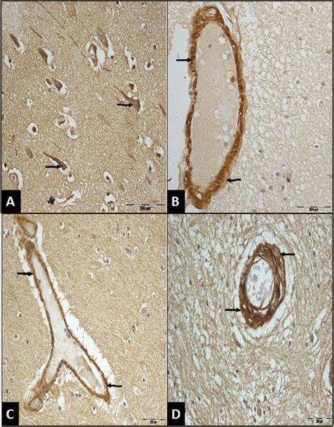 Immuno Localisation Of Thyroglobulin Tg In Normal Adult Human Brain