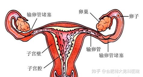 输卵管堵塞要及时预防 推荐3个治疗方法 知乎