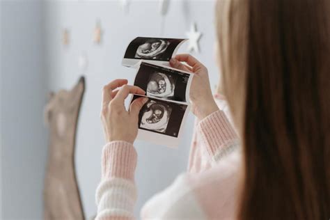 Une femme enceinte de quadruplés mais d une façon plus que rare