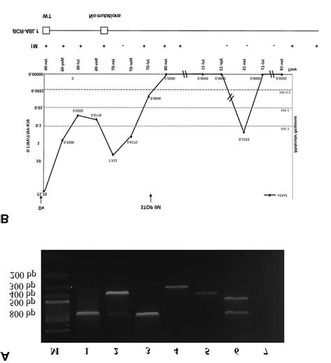 A Multiplex Rt Pcr Analysis Of The Different Bcr Abl Fusion