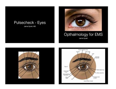 (PDF) Jamie Syrett, MD - NYSVARAMarcus Gunn Pupil • Afferent Pupillary ...