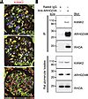 Jci Kank Deficiency Leads To Podocyte Dysfunction And Nephrotic Syndrome