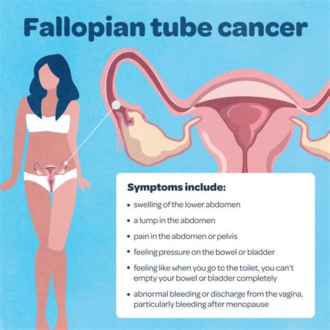 Fallopian Tube Cancer Treatment | Cancer Surgery | SSO Hospital