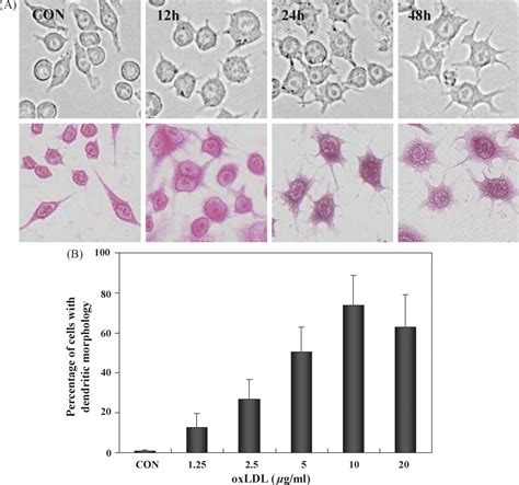 References In Oxidized Low Density Lipoprotein Induces Differentiation