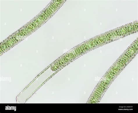 Oscillatoria Under A Microscope