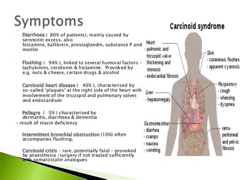 Apu Domas And Carcinoid Syndrome