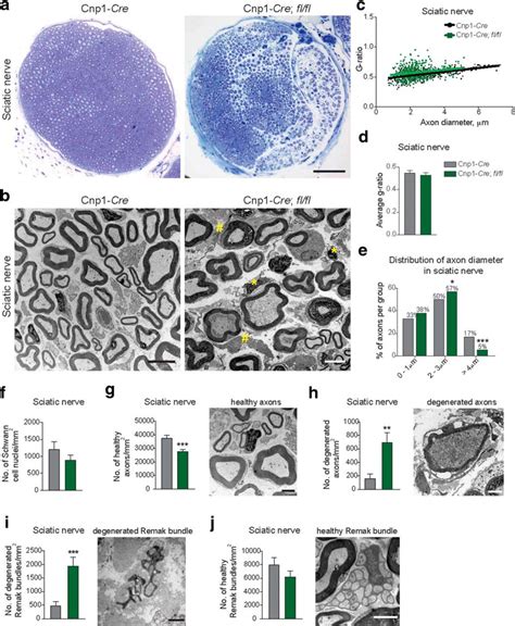 Myelinating Glia Specific Deletion Of Fbxo7 In Mice Triggers Axonal